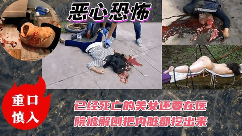 【噁心恐怖】已经死亡的美女还要在医院被解剖把内脏都挖出来!