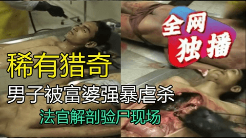 【稀有猎奇】该男子被富婆强暴后虐杀，法医正在解剖验尸