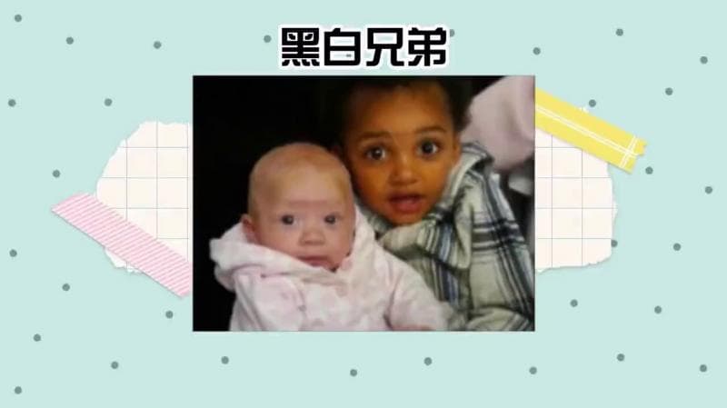 WTF黑人和一白人生出来的孩子竟然一黑一白 #美国达人秀