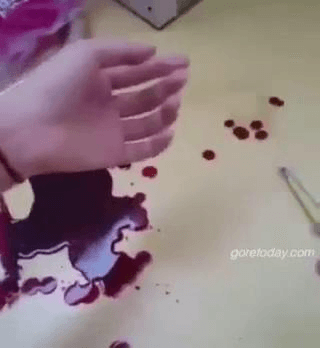 割腕自拍