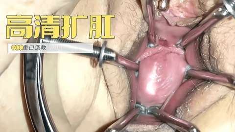 极限扩阴玩弄子宫