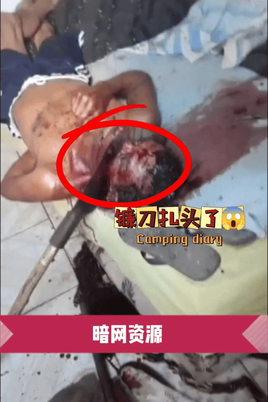 〔暗网资源〕镰刀扎进头了