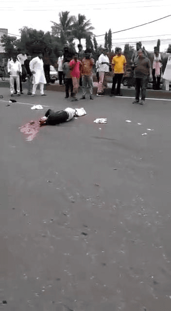 车祸太惨了妹子头皮撤掉男友脑袋碎了