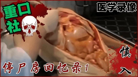 医学录像-停尸房回忆录