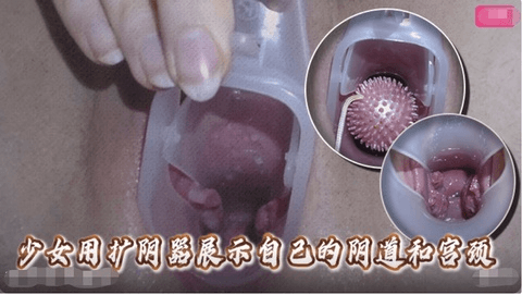 少女用扩阴器展示自己的阴道和宫颈